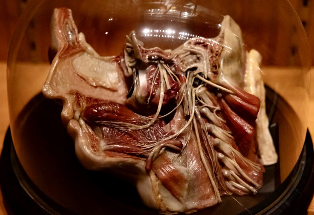 wax model of a dissected head