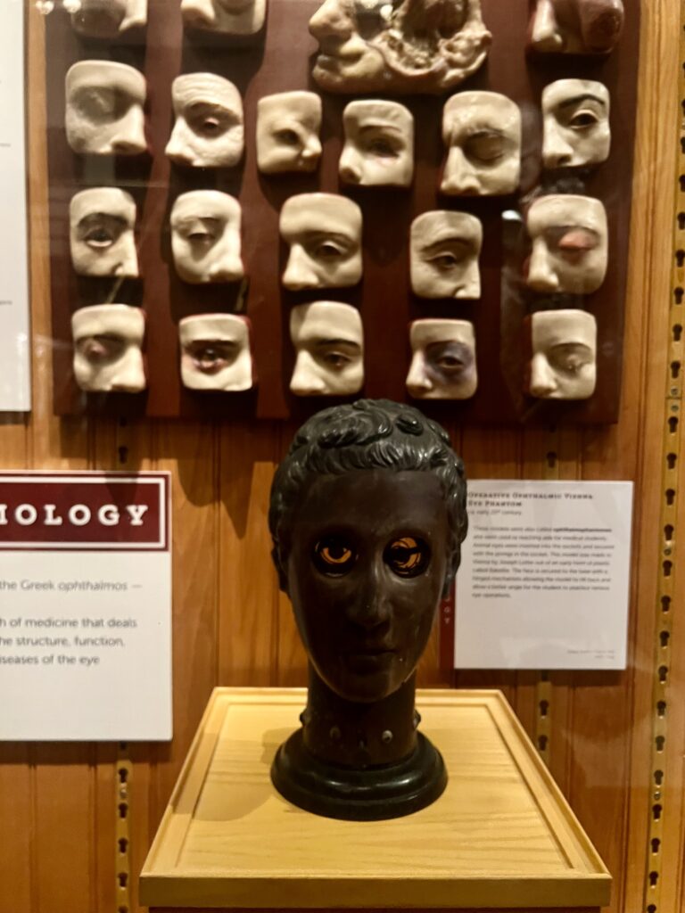 wax faces displaying eye injuries